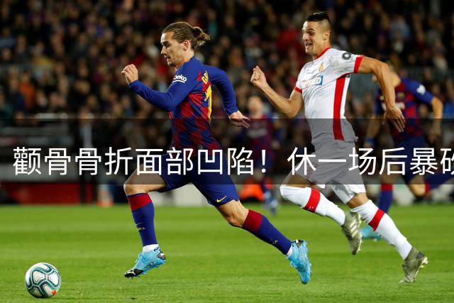 颧骨骨折面部凹陷！休一场后暴砍49+15+10！太威少了！